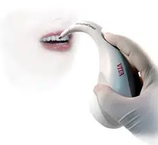 color matching teeth