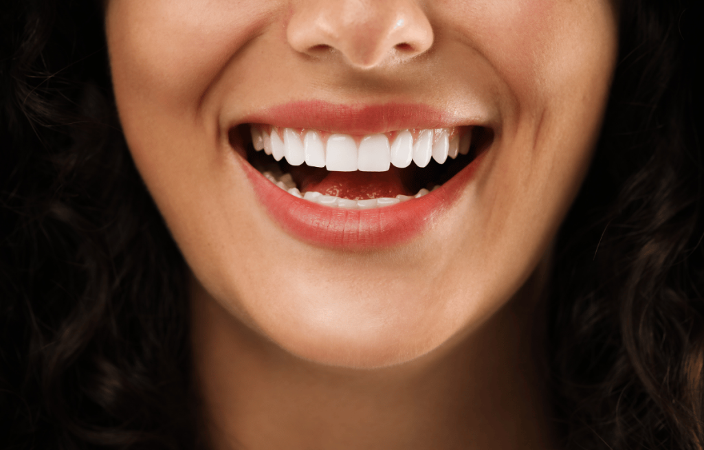women with new veneers