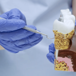 healthy gums being displayed by dentist