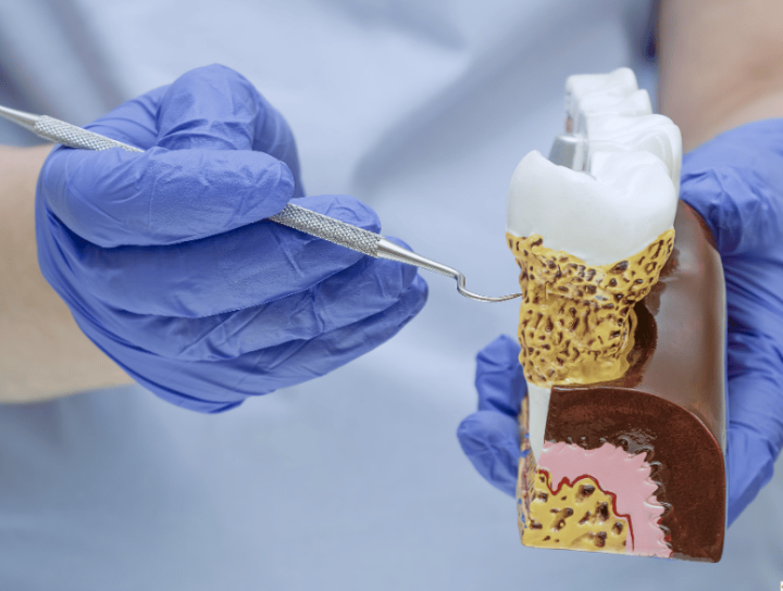 healthy gums being displayed by dentist