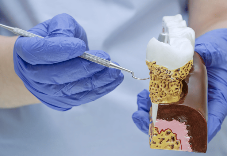 healthy gums being displayed by dentist