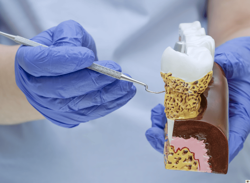 healthy gums being displayed by dentist