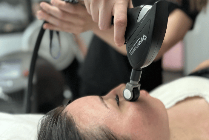 facial aesthetics patient in oceanside